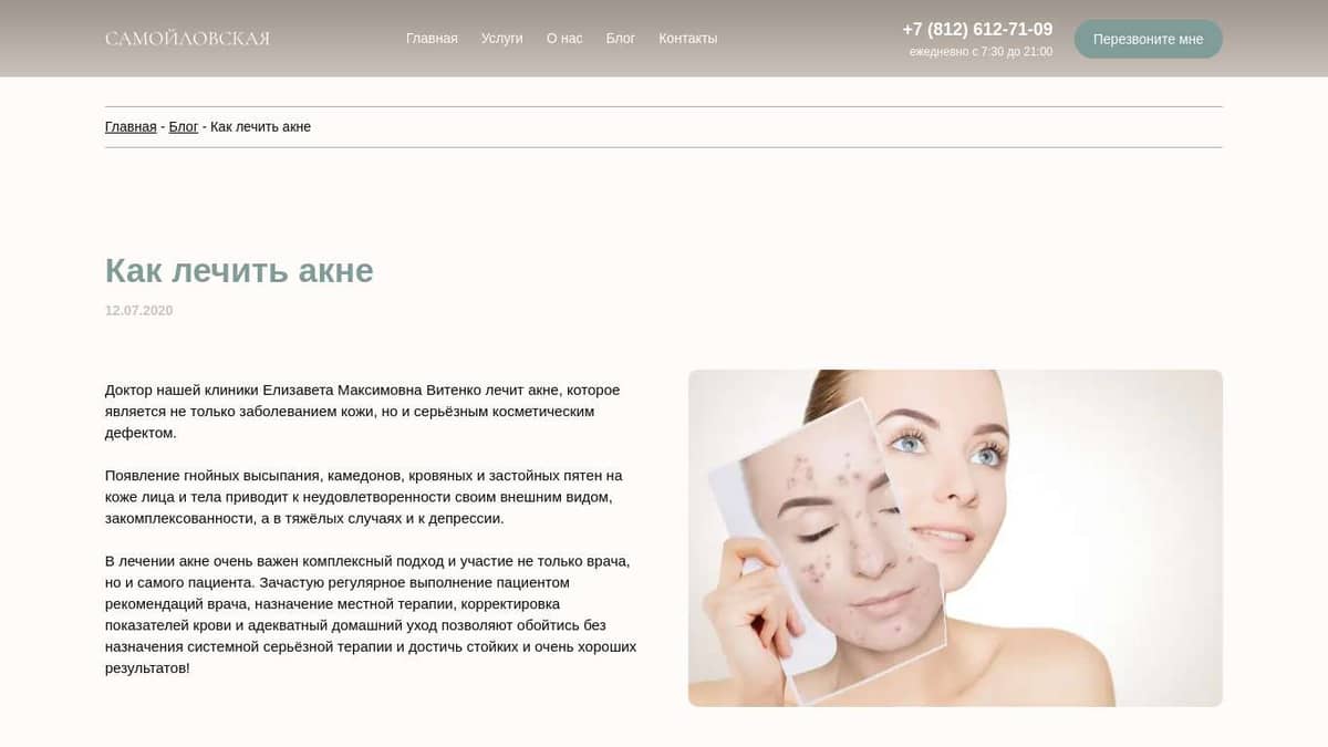 Как лечить акне